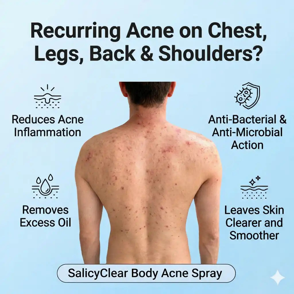 SalicyClear Body Acne Spray