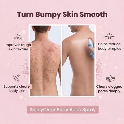 SalicyClear Body Acne Spray