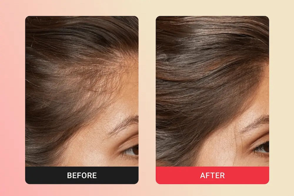 Haloskin & Hair Rejuvenation Wand