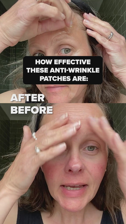 Wrinkle-Free Face Patches (20 Patches in a Box)